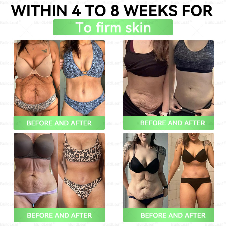 𝖮𝖿𝖿𝗂𝖼𝗂𝖺𝗅 𝖲𝗍𝗈𝗋𝖾 | 𝘽𝙪𝙞𝙡𝙙𝙇𝙚𝙖𝙛® 𝗚𝗟𝗣-𝟭𝟐𝟎-𝗶𝗻-𝟭 𝗦𝗹𝗶𝗺 & 𝑯𝒆𝒂𝒍𝒕𝒉 𝑶𝒓𝒂𝒍 𝑺𝒐𝒍𝒖𝒕𝒊𝒐𝒏(𝑂𝑛𝑐𝑒 𝑎 𝑑𝑎𝑦, 𝑣𝑖𝑠𝑖𝑏𝑙𝑒 𝑟𝑒𝑠𝑢𝑙𝑡𝑠 𝑖𝑛 7 𝑑𝑎𝑦𝑠) ✅ 𝗦𝘂𝗽𝗽𝗼𝗿𝘁𝘀 𝗼𝗯𝗲𝘀𝗶𝘁𝘆, 𝗰𝗮𝗿𝗱𝗶𝗼𝘃𝗮𝘀𝗰𝘂𝗹𝗮𝗿 𝗵𝗲𝗮𝗹𝘁𝗵, 𝗱𝗶𝗮𝗯𝗲𝘁𝗲𝘀, 𝘀𝗹𝗲𝗲𝗽 𝗮𝗽𝗻𝗲𝗮, 𝗴𝘂𝘁 𝗵𝗲𝗮𝗹𝘁𝗵, 𝗷𝗼𝗶𝗻𝘁 𝗶𝘀𝘀𝘂𝗲𝘀, 𝐰𝐡𝐢𝐥𝐞 𝐚𝐥𝐬𝐨 𝐟𝐢𝐫𝐦𝐢𝐧𝐠 𝐭𝐡𝐞 𝐬𝐤𝐢𝐧 𝐚𝐧𝐝 𝐛𝐨𝐨𝐬𝐭𝐢𝐧𝐠 𝐞𝐧𝐞𝐫𝐠𝐲.